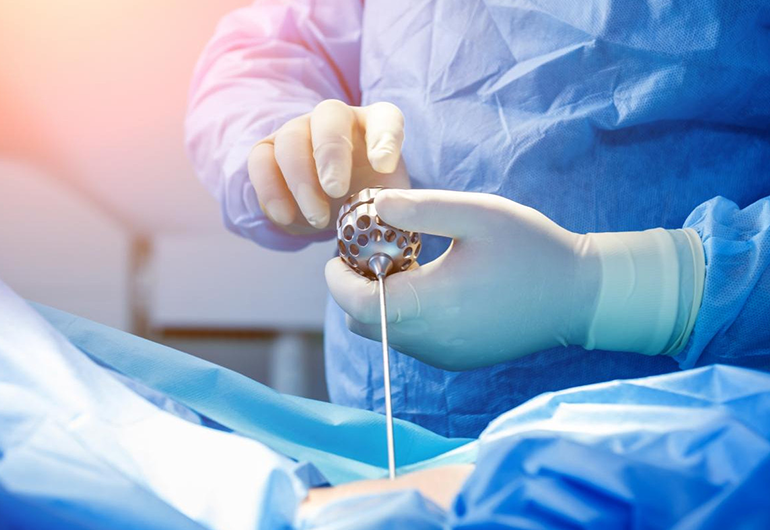 Endoscópica - Urologia Eliseu Denadai - Clínica de Urologia em São José do Rio Preto/SP