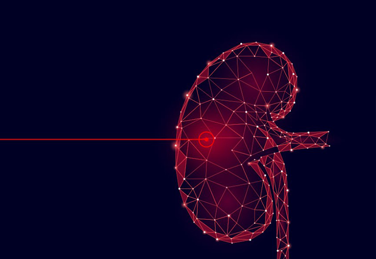 Laser - Urologia Eliseu Denadai - Clínica de Urologia em São José do Rio Preto/SP
