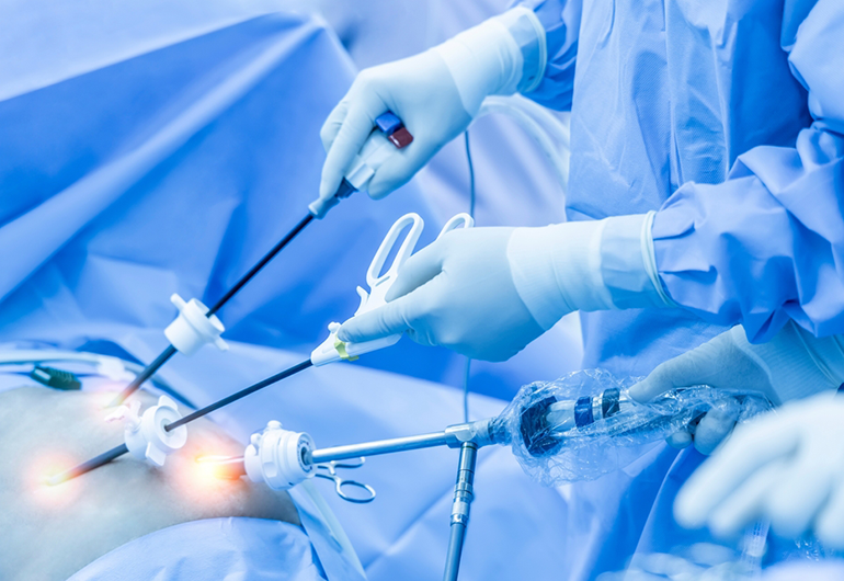 Videolaparoscópica - Urologia Eliseu Denadai - Clínica de Urologia em São José do Rio Preto/SP